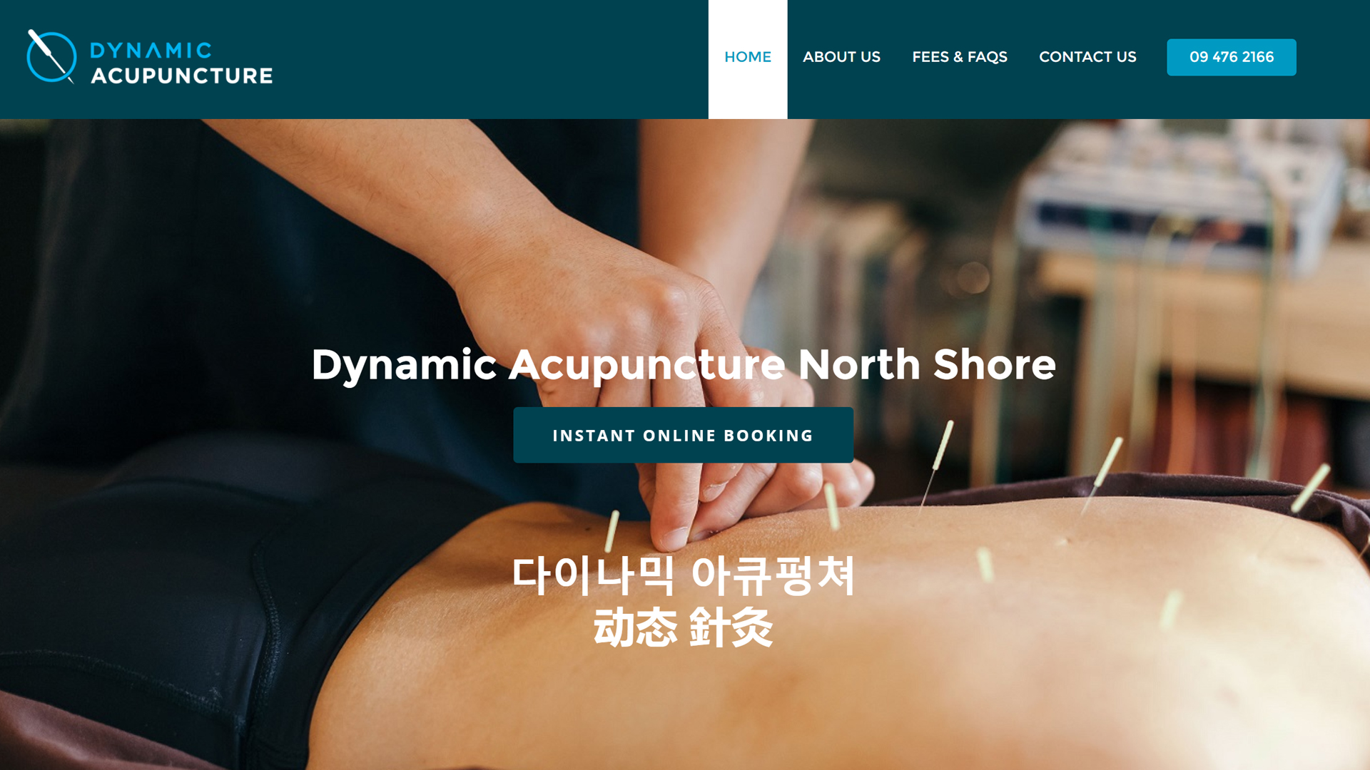 Dynamic Acupuncture